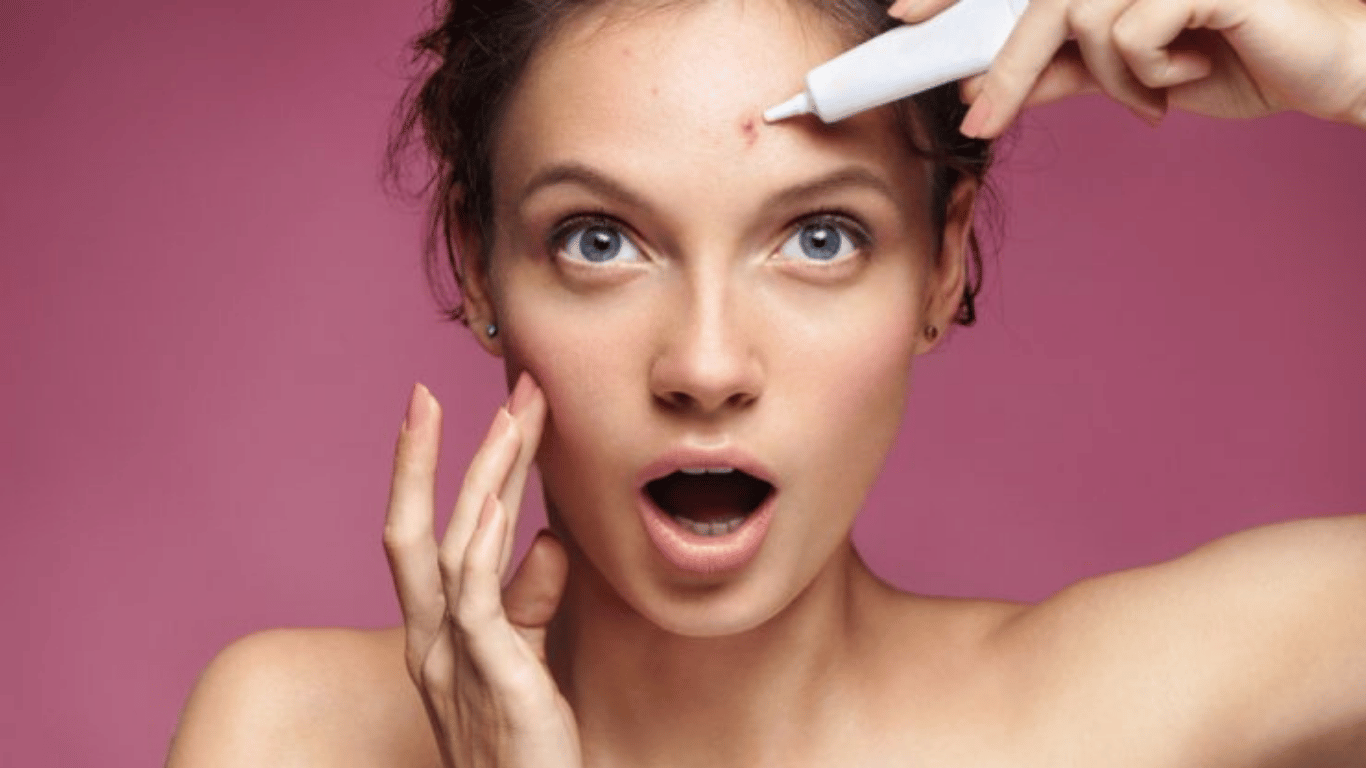 A Breakthrough in Acne Treatment – By Dr. Dany Touma